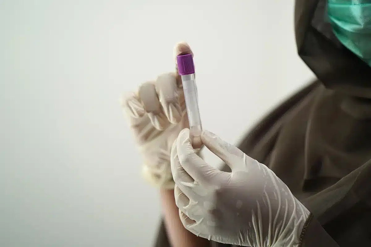 Toma de muestra de líquido cefalorraquídeo en laboratorio de investigación del sueño