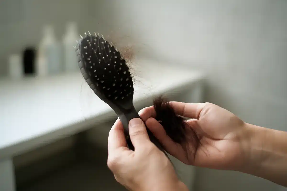 Recrecimiento capilar: fármaco contra artritis impulsa cabello en 1,400 pacientes con alopecia